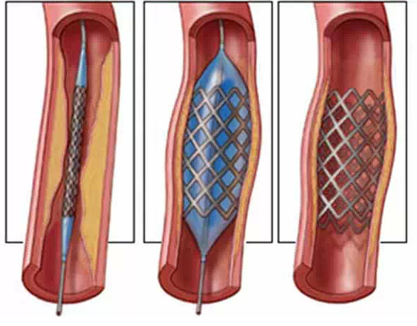 愛旺工業(yè)醫(yī)療行業(yè)設備案例 愛旺工業(yè)醫(yī)療行業(yè)設備案例